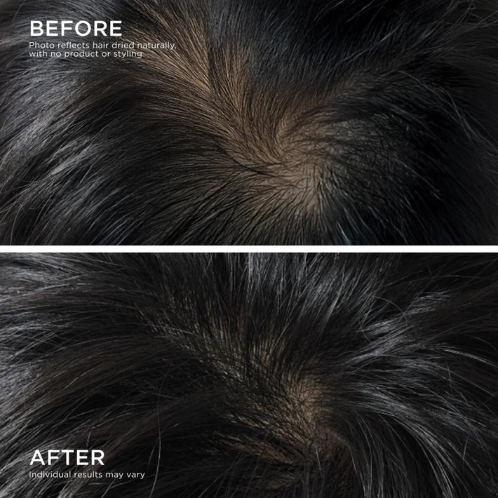 Before and After Results